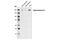 DNA Topoisomerase II Alpha antibody, 4733S, Cell Signaling Technology, Western Blot image 