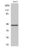 MAA antibody, STJ93988, St John