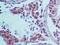 TRAF3 Interacting Protein 1 antibody, NBP2-14847, Novus Biologicals, Immunohistochemistry paraffin image 