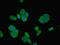 Rho Associated Coiled-Coil Containing Protein Kinase 2 antibody, LS-C376532, Lifespan Biosciences, Immunofluorescence image 