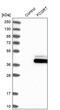 Fc Fragment Of IgG Receptor And Transporter antibody, PA5-52913, Invitrogen Antibodies, Western Blot image 