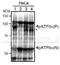 Activating Transcription Factor 6 antibody, 73-505, BioAcademia Inc, Western Blot image 