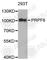 Pre-MRNA Processing Factor 6 antibody, A6821, ABclonal Technology, Western Blot image 