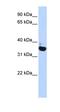 FLT3 Interacting Zinc Finger 1 antibody, orb324357, Biorbyt, Western Blot image 