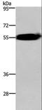 Activin A Receptor Type 2A antibody, LS-C405456, Lifespan Biosciences, Western Blot image 