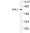 G Protein Nucleolar 1 (Putative) antibody, LS-C177460, Lifespan Biosciences, Western Blot image 