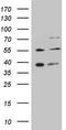 G Protein-Coupled Receptor Kinase 4 antibody, LS-C798297, Lifespan Biosciences, Western Blot image 