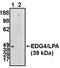 Lysophosphatidic acid receptor 2 antibody, MBS395948, MyBioSource, Western Blot image 