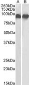 Integrin Subunit Beta 2 antibody, MBS423409, MyBioSource, Western Blot image 