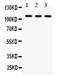 CYLD Lysine 63 Deubiquitinase antibody, PB9543, Boster Biological Technology, Western Blot image 