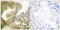 G1/S-specific cyclin-D3 antibody, LS-C198863, Lifespan Biosciences, Immunohistochemistry paraffin image 