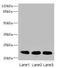 Cysteine Rich Protein 2 antibody, LS-C675589, Lifespan Biosciences, Western Blot image 