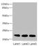 CRIP2 antibody, LS-C675589, Lifespan Biosciences, Western Blot image 