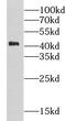 G Protein-Coupled Receptor Class C Group 5 Member A antibody, FNab03614, FineTest, Western Blot image 
