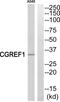 Cell Growth Regulator With EF-Hand Domain 1 antibody, PA5-39086, Invitrogen Antibodies, Western Blot image 