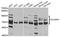 Solute Carrier Family 20 Member 1 antibody, A4117, ABclonal Technology, Western Blot image 
