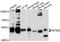 Eukaryotic Translation Initiation Factor 2B Subunit Gamma antibody, abx125805, Abbexa, Western Blot image 