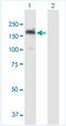 Phosphatidylinositol Transfer Protein Membrane Associated 1 antibody, H00009600-B01P-50ug, Novus Biologicals, Western Blot image 