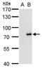 SLU7 Homolog, Splicing Factor antibody, MA5-18304, Invitrogen Antibodies, Western Blot image 