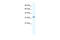 Ankyrin repeat and zinc finger domain-containing protein 1 antibody, 28-392, ProSci, Western Blot image 