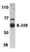 Interleukin 22 Receptor Subunit Alpha 1 antibody, orb74459, Biorbyt, Western Blot image 