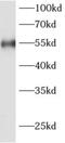 Adenosine Deaminase TRNA Specific 1 antibody, FNab00152, FineTest, Western Blot image 