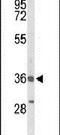 Bombesin Receptor Subtype 3 antibody, PA5-26484, Invitrogen Antibodies, Western Blot image 