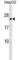 Major Histocompatibility Complex, Class II, DP Alpha 1 antibody, abx029786, Abbexa, Western Blot image 