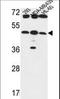 UDP-GlcNAc:BetaGal Beta-1,3-N-Acetylglucosaminyltransferase 5 antibody, LS-C156712, Lifespan Biosciences, Western Blot image 