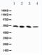 Receptor Interacting Serine/Threonine Kinase 3 antibody, LS-C313343, Lifespan Biosciences, Western Blot image 