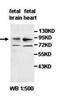 High Mobility Group Box 4 antibody, orb77702, Biorbyt, Western Blot image 