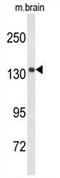 Histone demethylase UTY antibody, AP54497PU-N, Origene, Western Blot image 