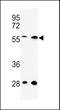 Spindle and kinetochore-associated protein 3 antibody, GTX80639, GeneTex, Western Blot image 