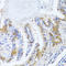 N-Acetyltransferase 2 antibody, A00966, Boster Biological Technology, Immunohistochemistry frozen image 