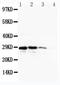 CUE Domain Containing 2 antibody, PA1962, Boster Biological Technology, Western Blot image 