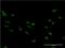Forkhead Box M1 antibody, H00002305-M07, Novus Biologicals, Immunocytochemistry image 