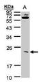 Ubiquitin Conjugating Enzyme E2 M antibody, GTX101653, GeneTex, Western Blot image 