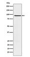 RAP1 GTPase Activating Protein antibody, M03561, Boster Biological Technology, Western Blot image 