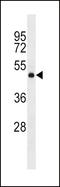 Dopamine Receptor D2 antibody, LS-C167533, Lifespan Biosciences, Western Blot image 