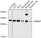 Proteasome Subunit Alpha 7 antibody, GTX64902, GeneTex, Western Blot image 