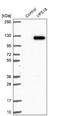 VPS18 Core Subunit Of CORVET And HOPS Complexes antibody, NBP1-82906, Novus Biologicals, Western Blot image 