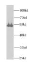 Dihydrolipoyl dehydrogenase, mitochondrial antibody, FNab02406, FineTest, Western Blot image 