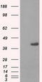 Protein Phosphatase Methylesterase 1 antibody, TA500822, Origene, Western Blot image 