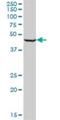 Ring Finger Protein 1 antibody, H00006015-M03, Novus Biologicals, Western Blot image 