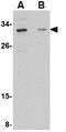 Growth Hormone Regulated TBC Protein 1 antibody, GTX31340, GeneTex, Western Blot image 