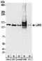 Leucyl-TRNA Synthetase antibody, NBP2-32208, Novus Biologicals, Western Blot image 