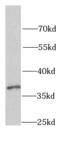 Poly(rC)-binding protein 1 antibody, FNab03951, FineTest, Western Blot image 