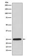 Hypoxanthine Phosphoribosyltransferase 1 antibody, M00668, Boster Biological Technology, Western Blot image 