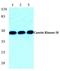 Casein Kinase 1 Delta antibody, A03132, Boster Biological Technology, Western Blot image 