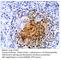 CD163 antibody, CD163-101AP, FabGennix, Immunohistochemistry paraffin image 